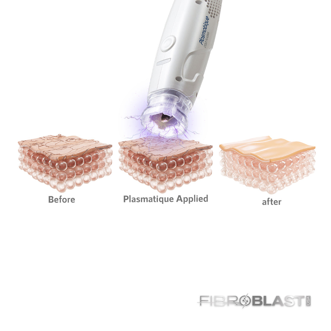 Fibroblast USA