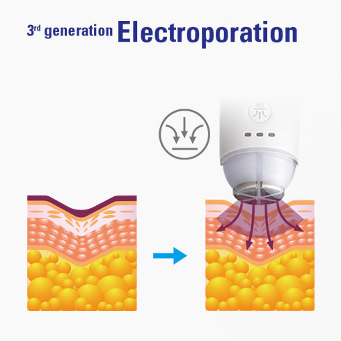 Fibroblast USA