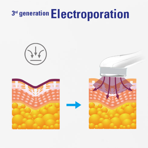 Fibroblast USA